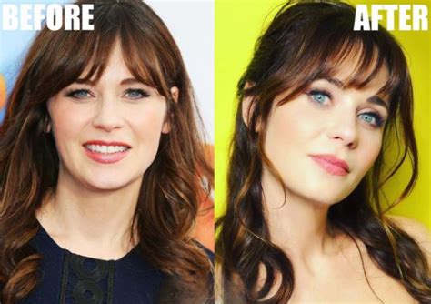 Zooey Deschanel Plastic Surgery: Then and Now Photos